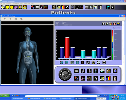 EIS scan